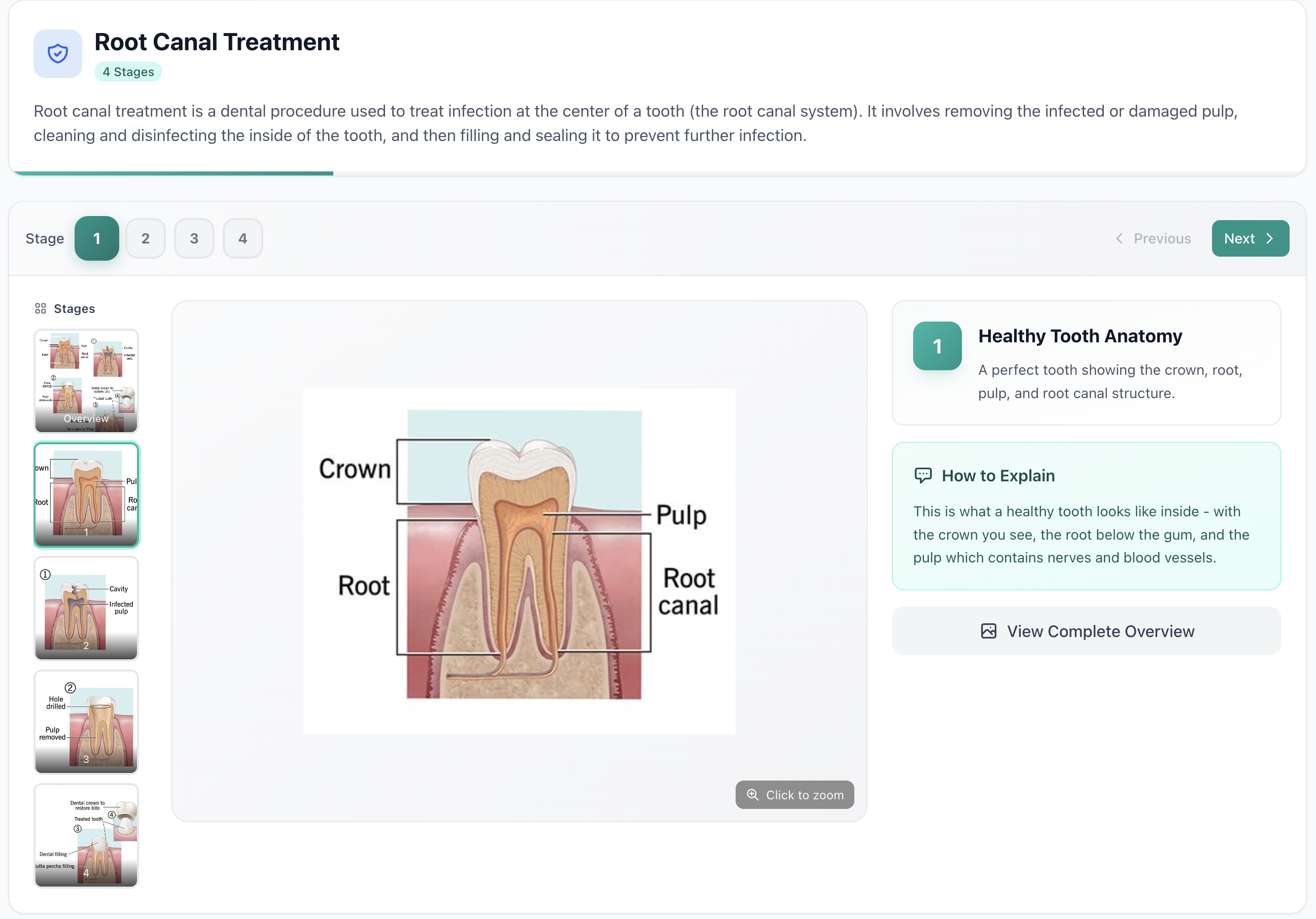 Consultation aid with treatment stage illustrations